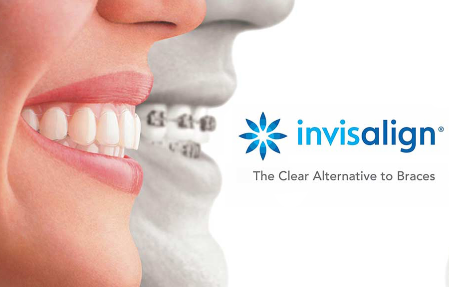 invisalign invisalign
